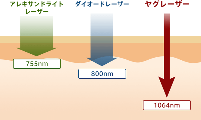 波長の長さが異なる3つのレーザー